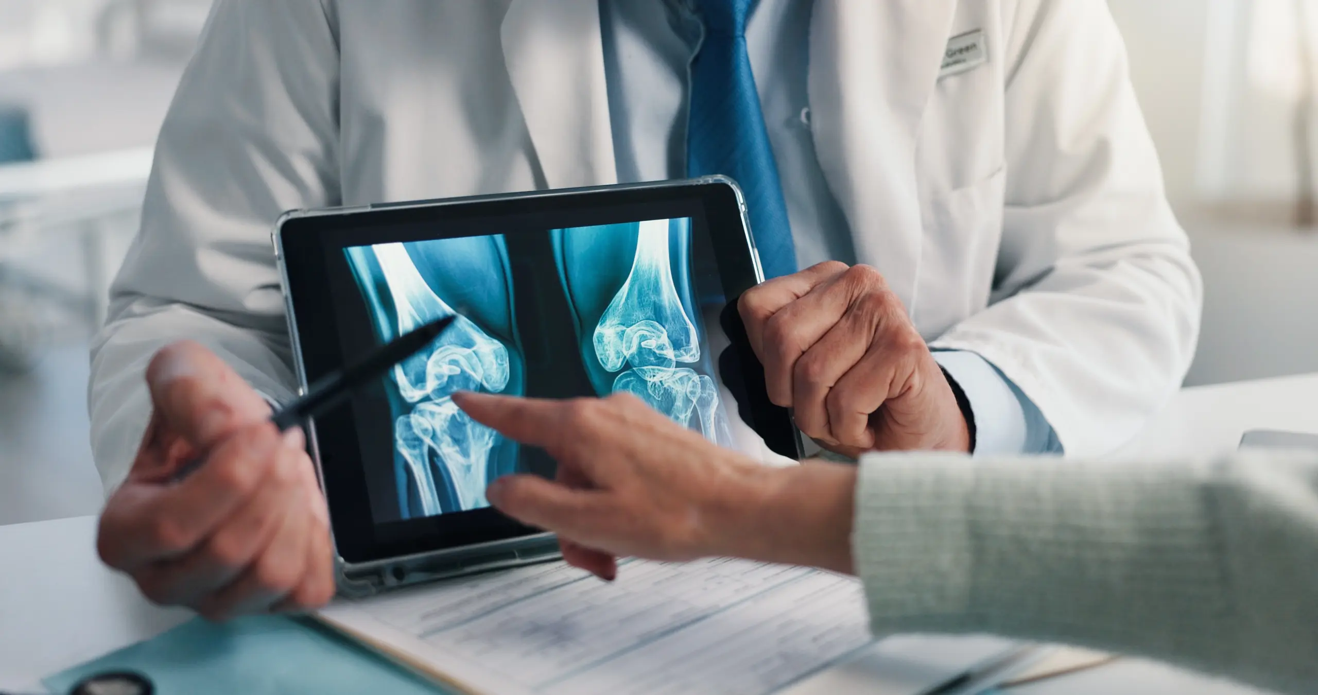 Dodaci prehrani u prevenciji i usporavanju osteoporoze – što pokazuju najnoviji dokazi?