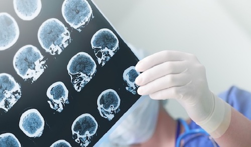 Neurologija