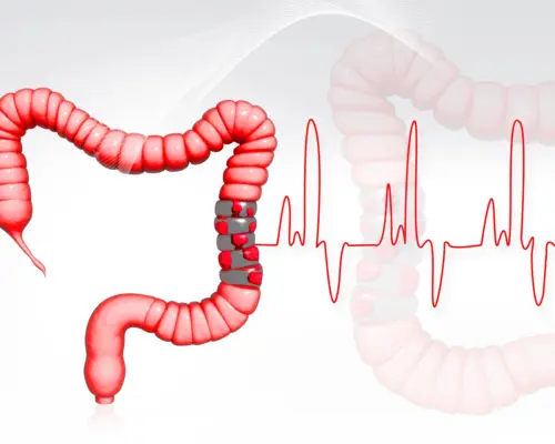 Depositphotos_4537086_L